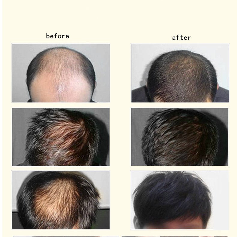 Ginger Anti - hair Loss Hair Maintenance 30ml - Zambeel