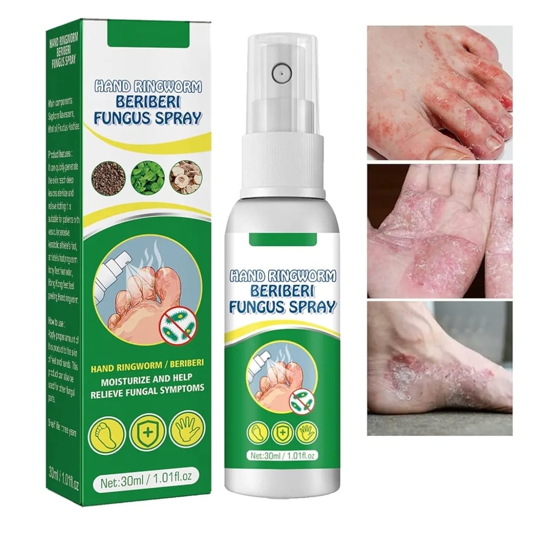 Hand Ringworm Beriberi Fungus Spray (Original) - Zambeel