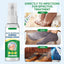 Hand Ringworm Beriberi Fungus Spray (Original) - Zambeel