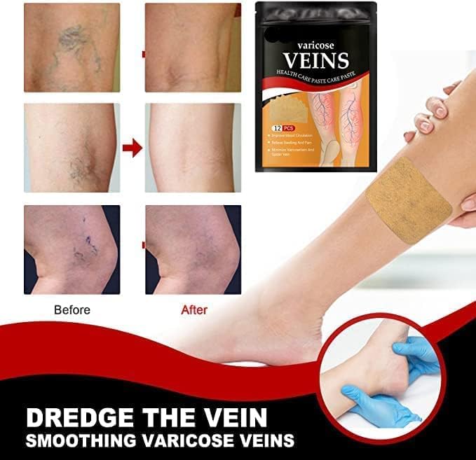 Hanel - Varicose Veins Patch (Original) - Zambeel