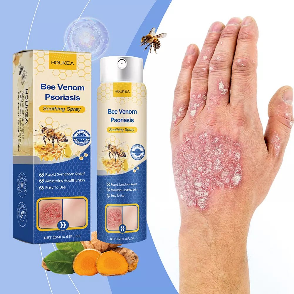 HOUKEA - Bee Venom Psoriasis Soothing Spray (Original) - Zambeel