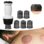 Intelligent Negative Pressure Cupping Massage Instrument - Zambeel