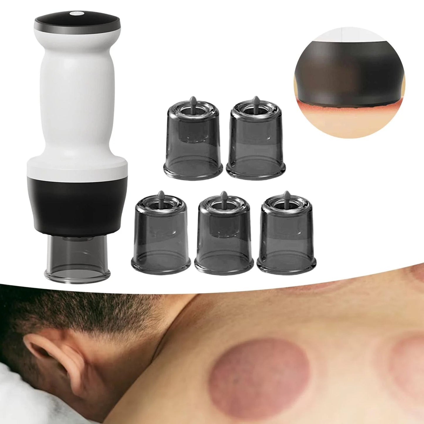 Intelligent Negative Pressure Cupping Massage Instrument - Zambeel