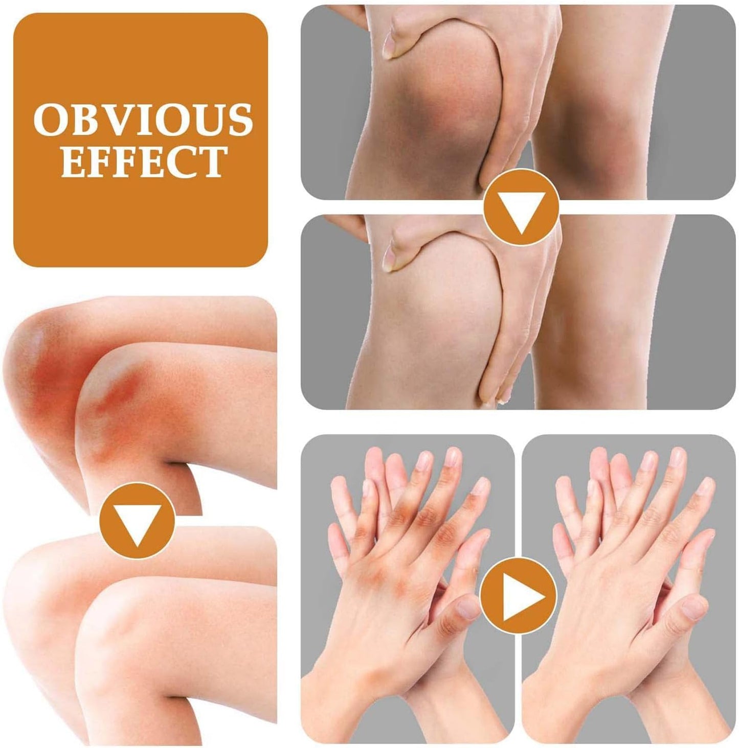 Jaysuing - Dark Spot Correcting Cream - Zambeel