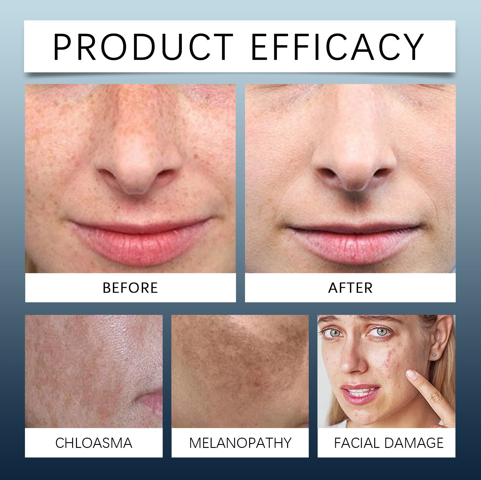 Jaysuing - Day & Night Cream Kit - Zambeel