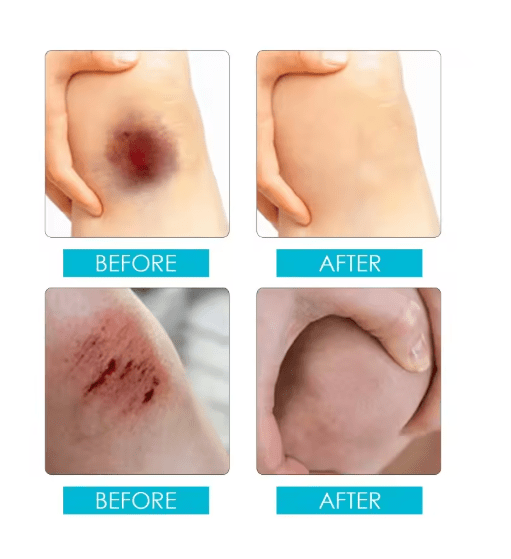 Jaysuing - Liquid Wound Dressing (Original) - Zambeel