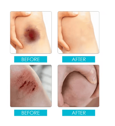 Jaysuing - Liquid Wound Dressing (Original) - Zambeel