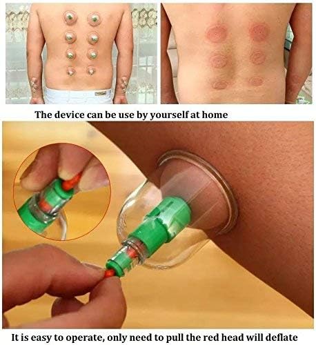 KN - Pull Out Vacuum Apparatus - Zambeel