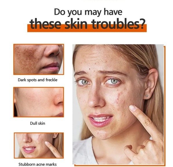 Kojic Acid Soap Skin Cleaning Facial Soap - Zambeel