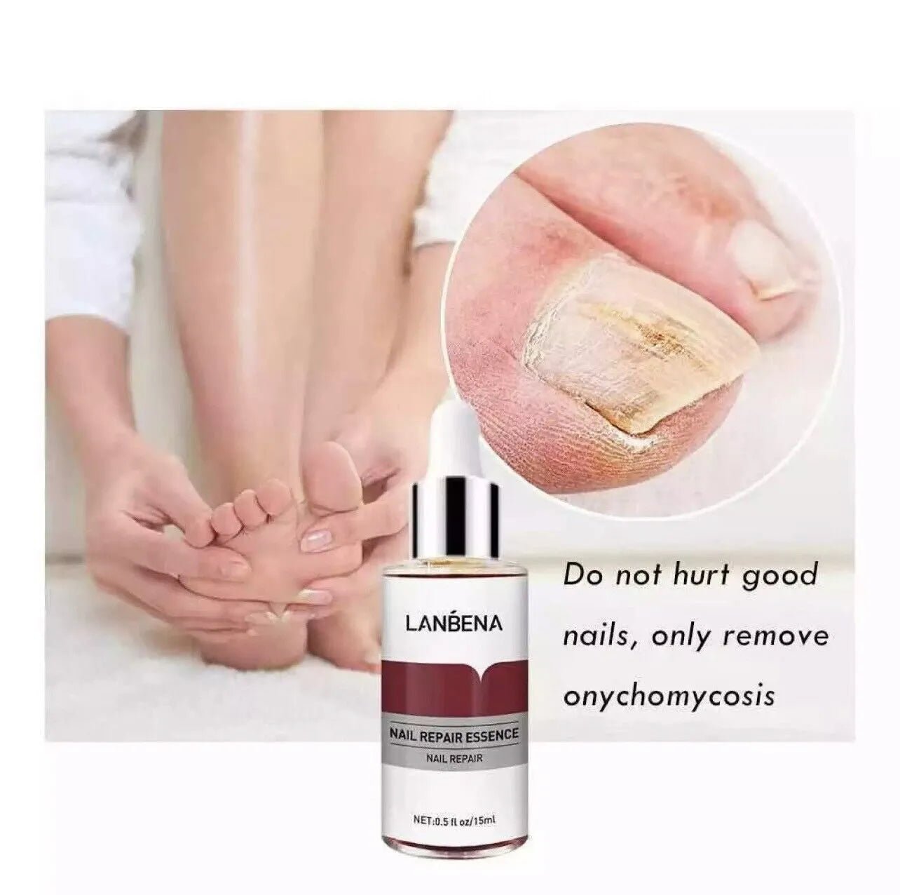 Lanbena - Nail Repair Essence - Zambeel