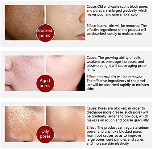 LANBENA - Pore Solution Serum (Original) - Zambeel