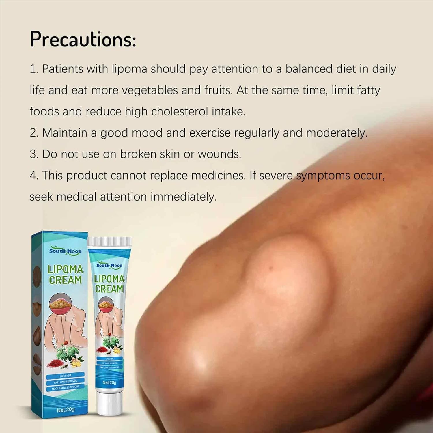 Lipoma Cyst Remover Cream (20g) - Zambeel