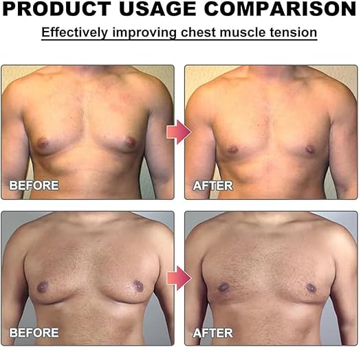 Men Therm - Bee Venom Gynecomastia Heating Oil (Original) - Zambeel