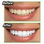 Miracle Teeth Whitener - Zambeel