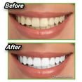 Miracle Teeth Whitener - Zambeel