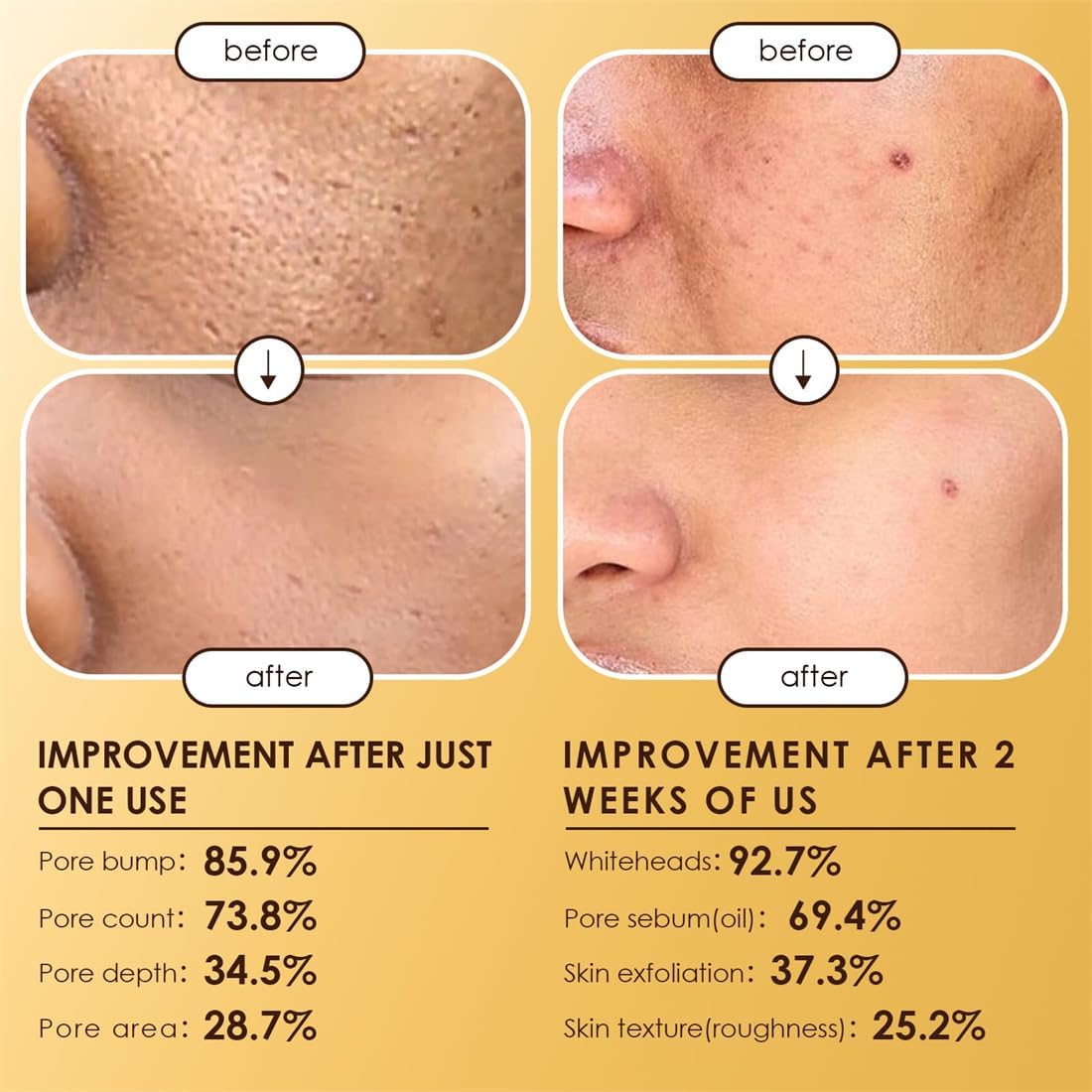 Moolinse Peel Shot P5 Exfoliant Ampoule (Pack of 2) - Zambeel