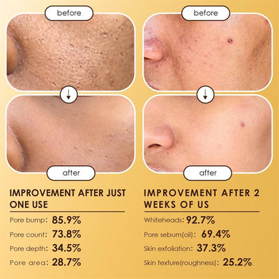 Moolinse Peel Shot P5 Exfoliant Ampoule (Pack of 2) - Zambeel