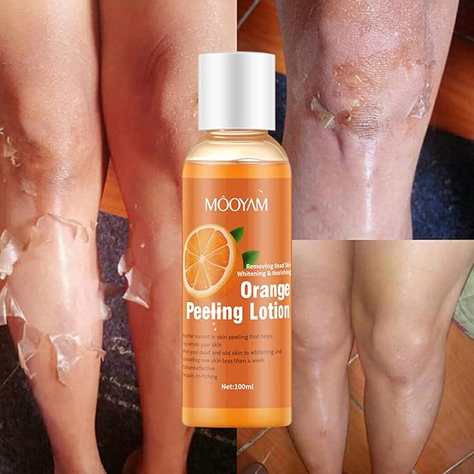 Mooyam - Orange Peeling Lotion (Original) - Zambeel