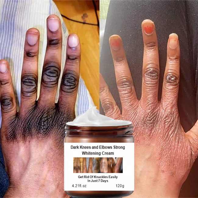 Mooyam - Whitening Cream (Original) - Zambeel