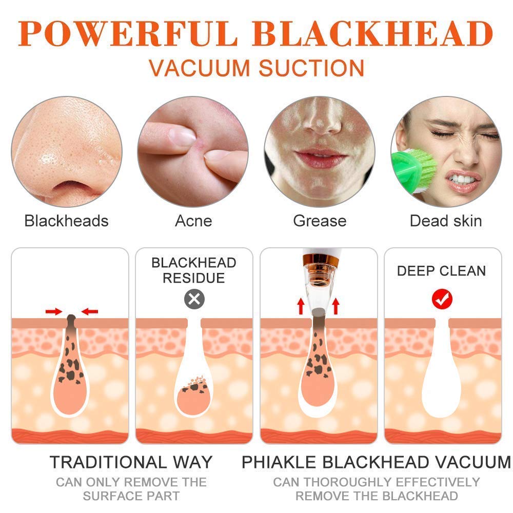 Multi - Functional Blackhead Remover - Zambeel