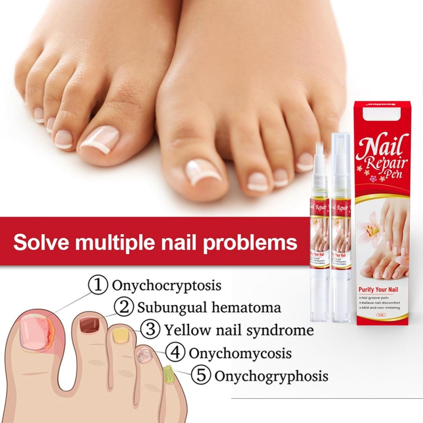 Nail Repair Pen - Zambeel