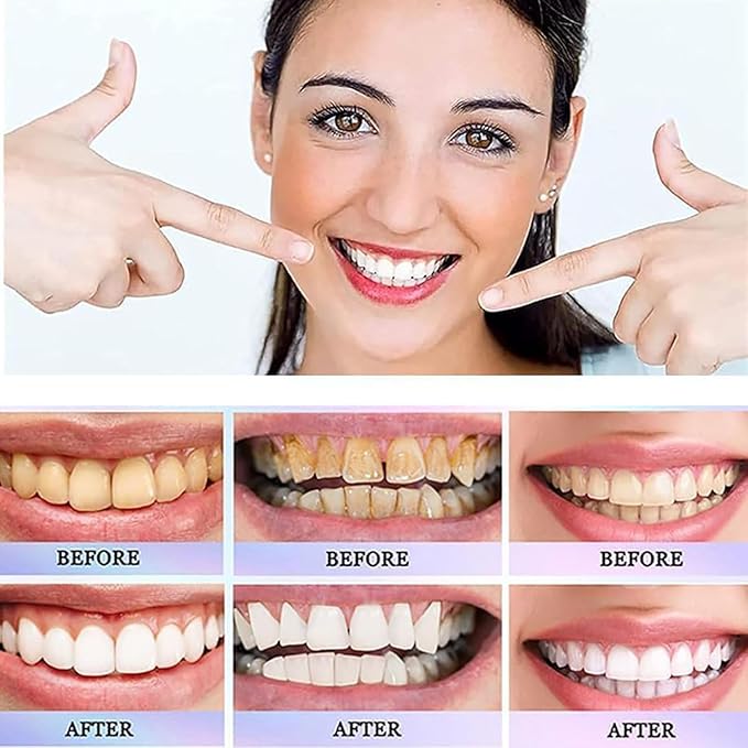 Oralhoe - Nicotinamide Dazzle White Toothpaste (Original) - Zambeel