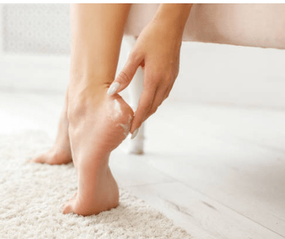 Rose Berry - Callus Therapy Remover Cream (Original) - Zambeel