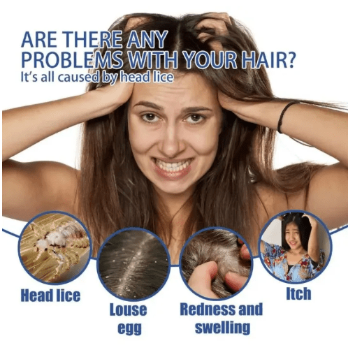 Scabies - Lice Spray (Original) - Zambeel