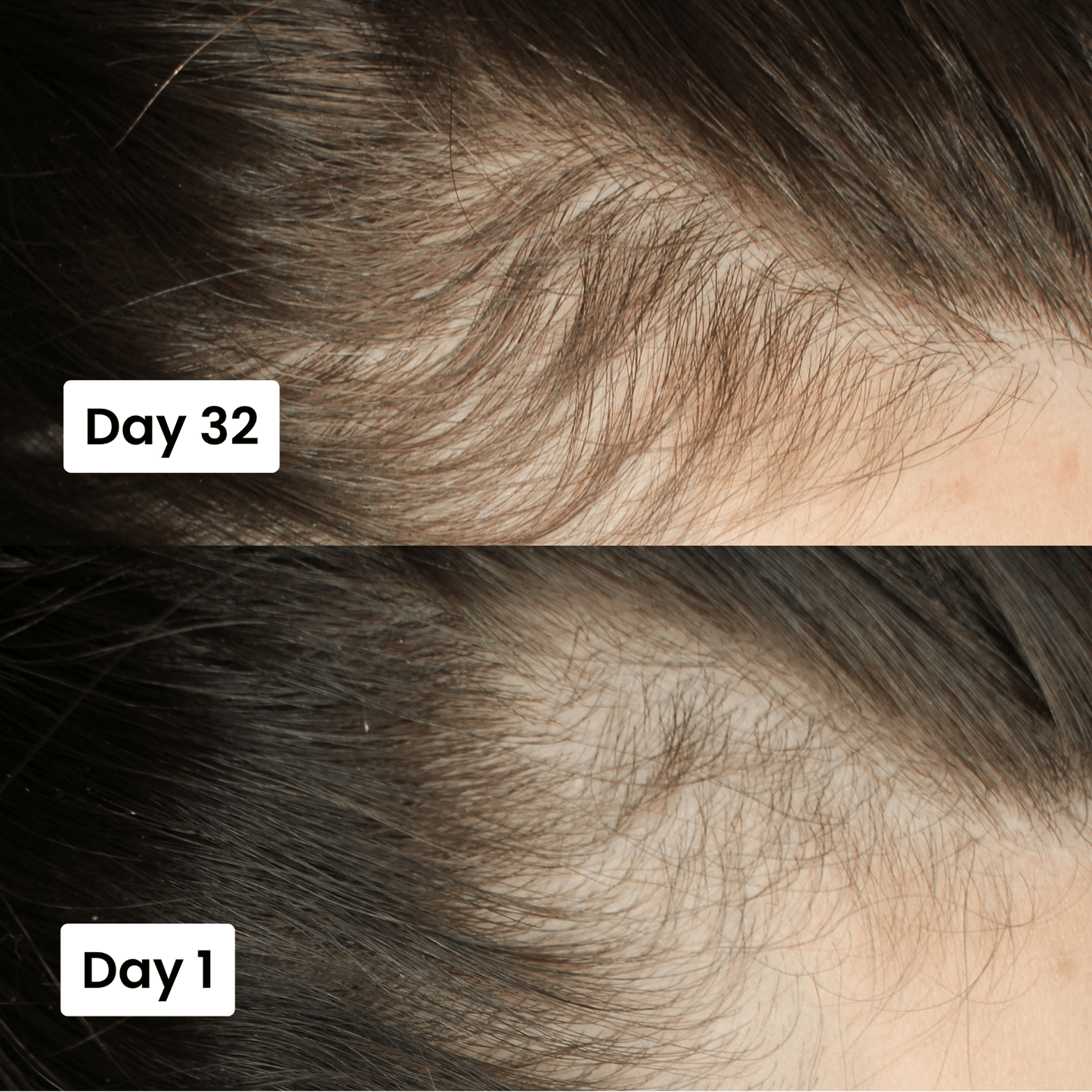 Scalp Hair Growth Serum - Zambeel