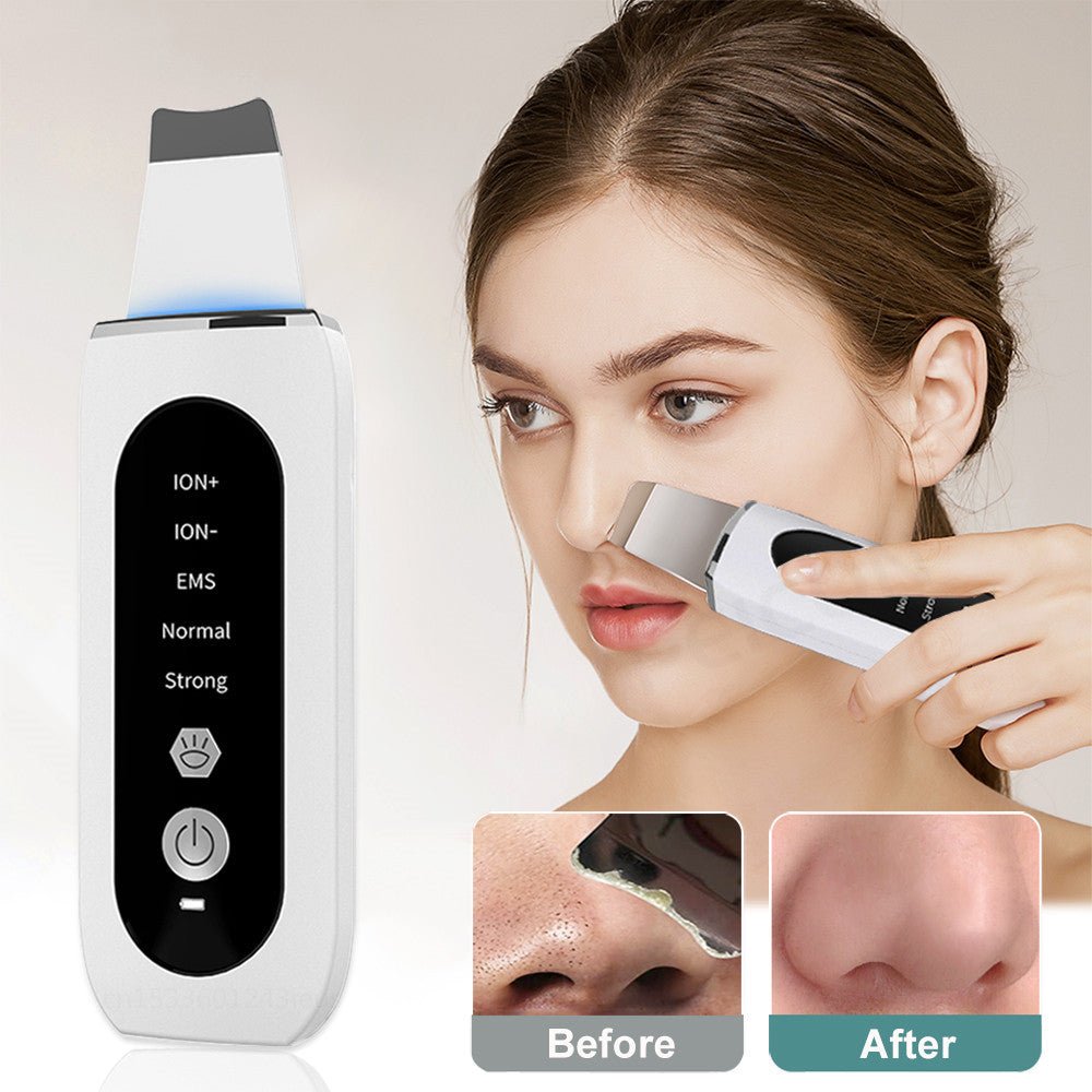 Shovel Skin Blackhead Ultrasonic Beauty Microcurrent Color Light - Zambeel