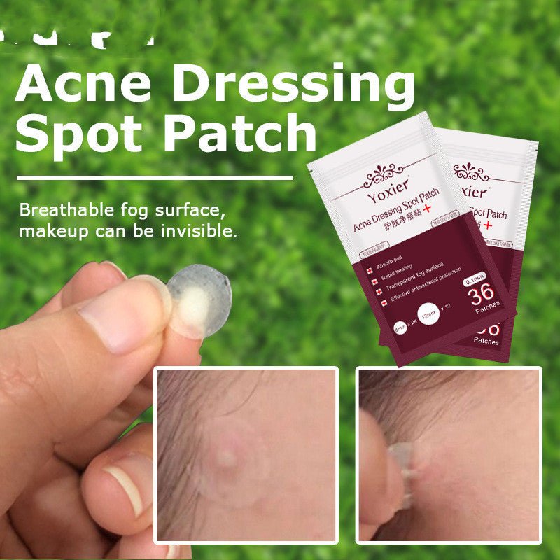 Skin Care Tools Acne Dressing Spot Patch Blemish Treatment Invisible Acne Stickers Pimple Remover Set Face Cream - Zambeel