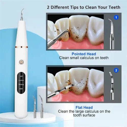 Smart Ultra - Sonic Teeth Cleaner - Zambeel