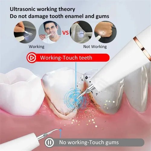 Smart Ultra - Sonic Teeth Cleaner - Zambeel