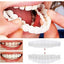 Smile Veneers - Zambeel