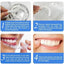 Smile Veneers - Zambeel