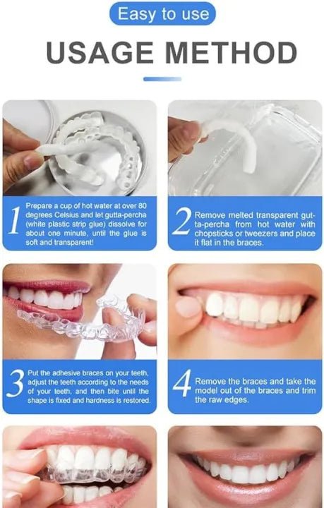 Smile Veneers - Zambeel