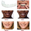 Smile Veneers - Zambeel
