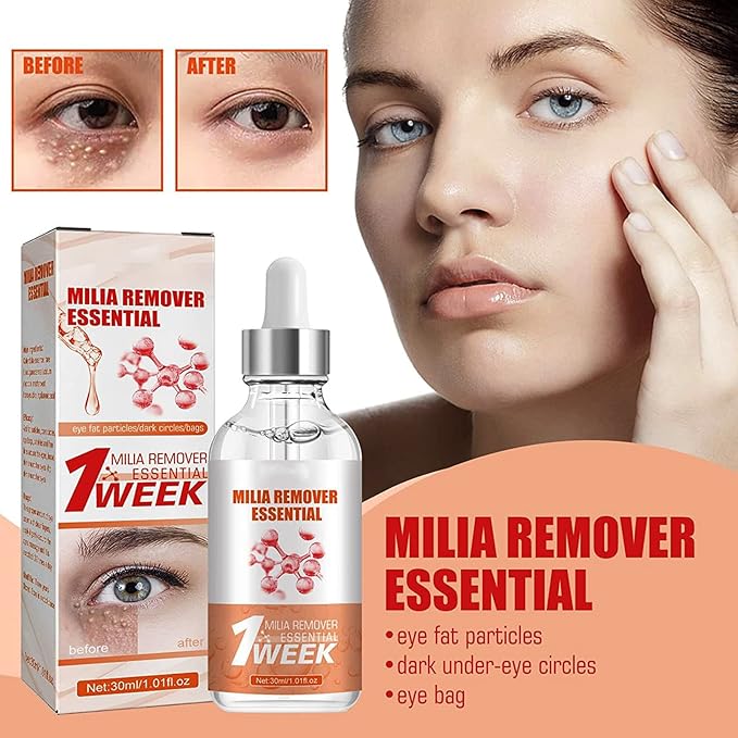 Smooth Milia Remover Serum (30ml) - Zambeel