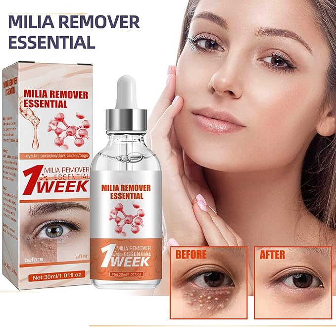 Smooth Milia Remover Serum (30ml) - Zambeel