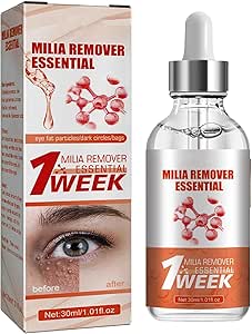 Smooth Milia Remover Serum (30ml) - Zambeel