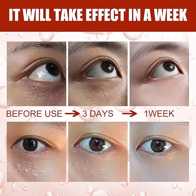 Smooth Milia Remover Serum (30ml) - Zambeel