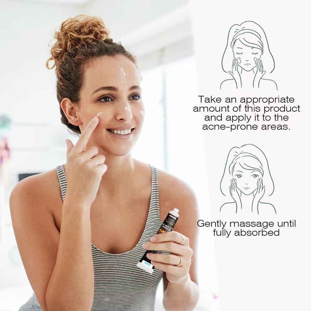 Snmifun - Bee Anti - Acne Gel - Zambeel