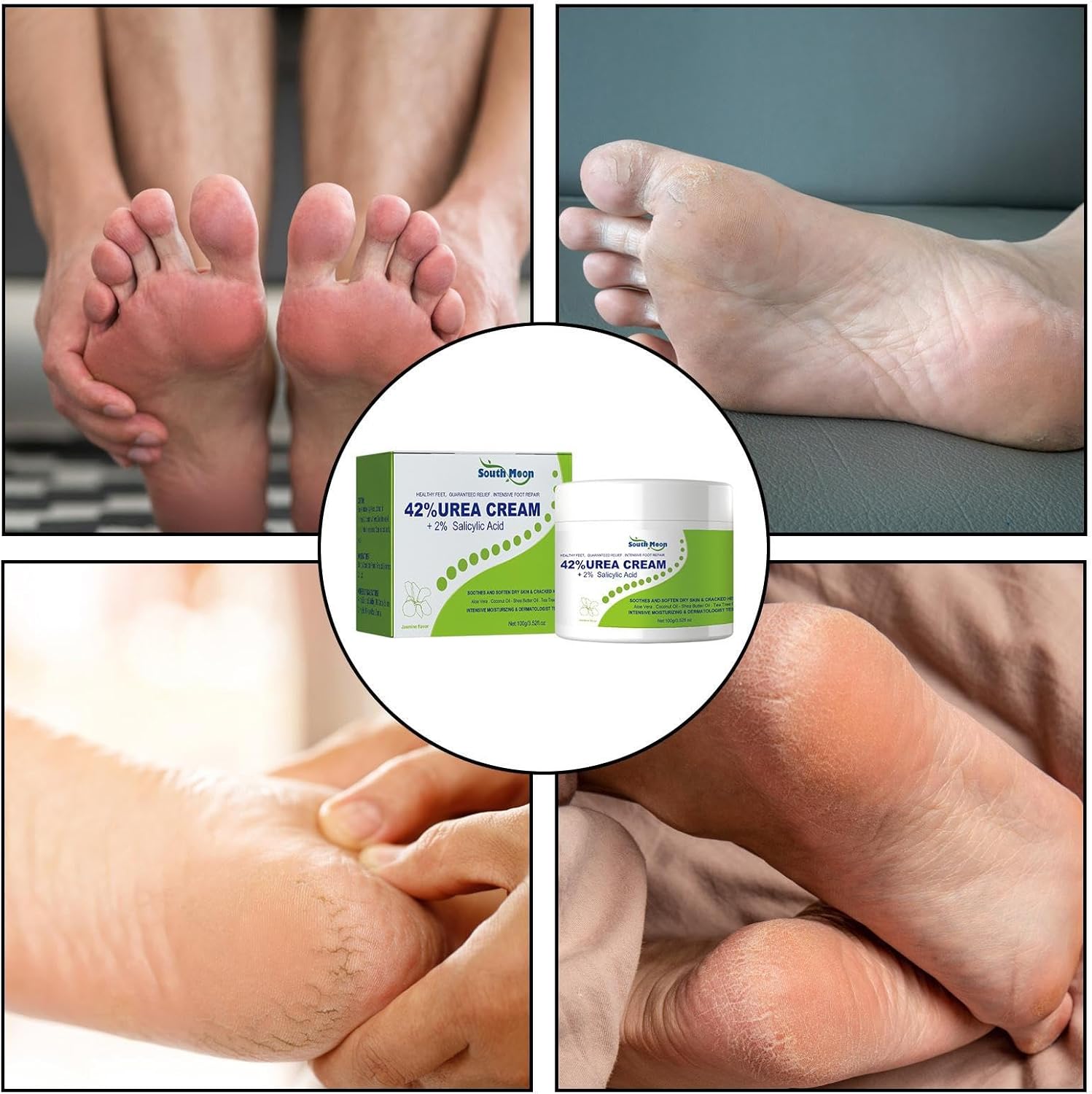 South Moon - 42% Urea Cream + 2% Salicylic Acid (Original) - Zambeel