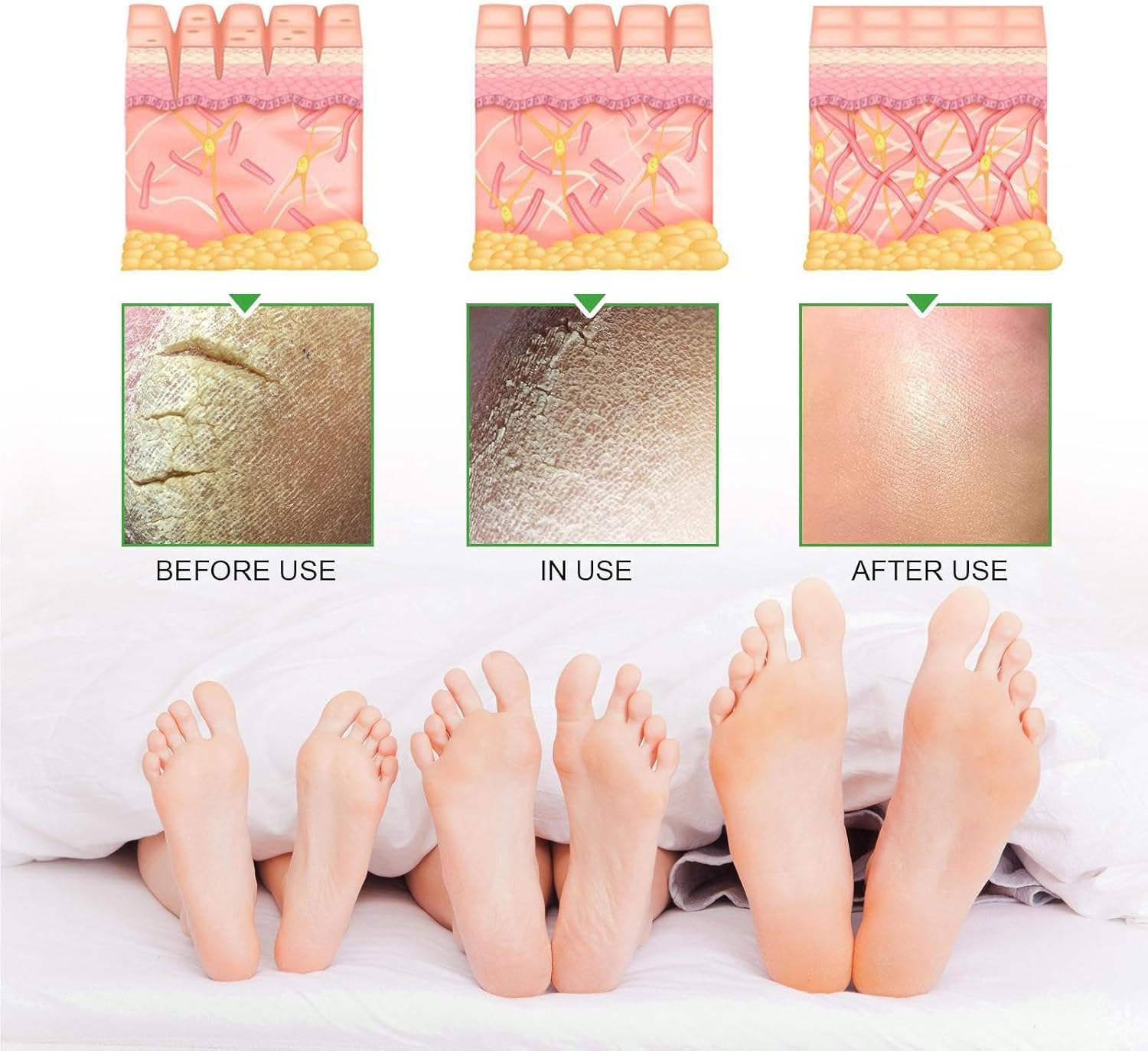 South Moon - 42% Urea Cream + 2% Salicylic Acid (Original) - Zambeel
