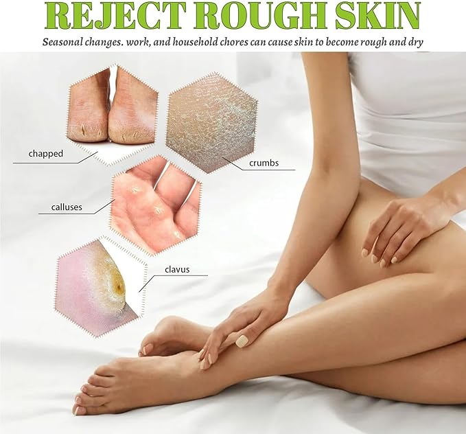 South Moon - 42% Urea Cream (Original) - Zambeel