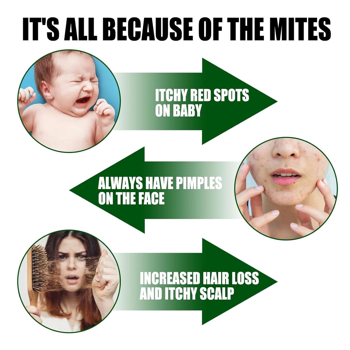 South Moon - Green Prickly Ash Herbal Mite Remover (Original) - Zambeel