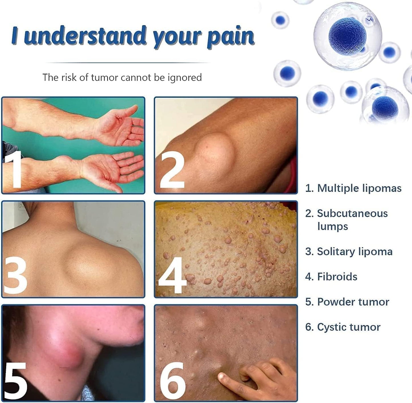 South Moon - Lipoma Removal Spray - Zambeel