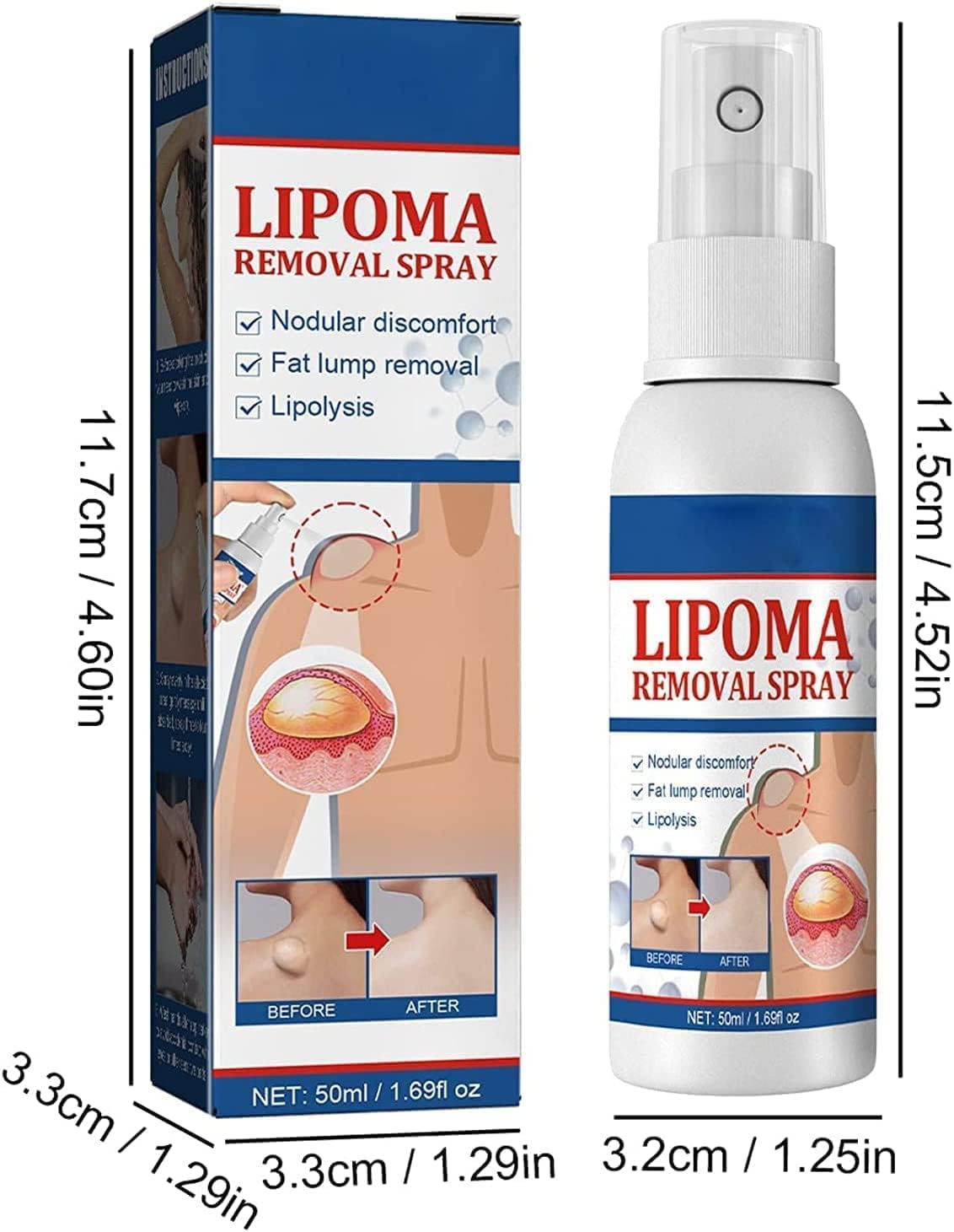 South Moon - Lipoma Removal Spray - Zambeel