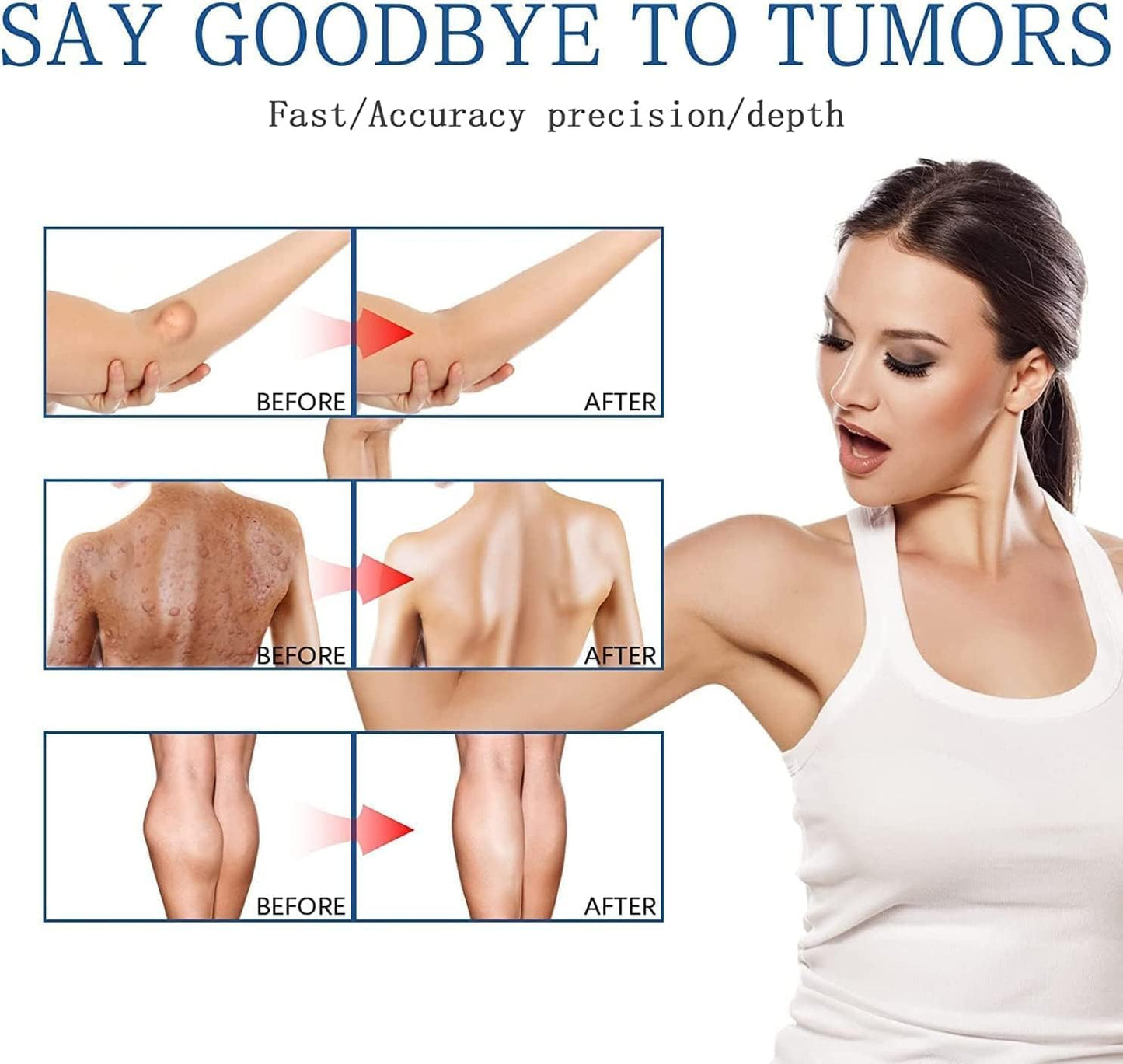 South Moon - Lipoma Removal Spray - Zambeel