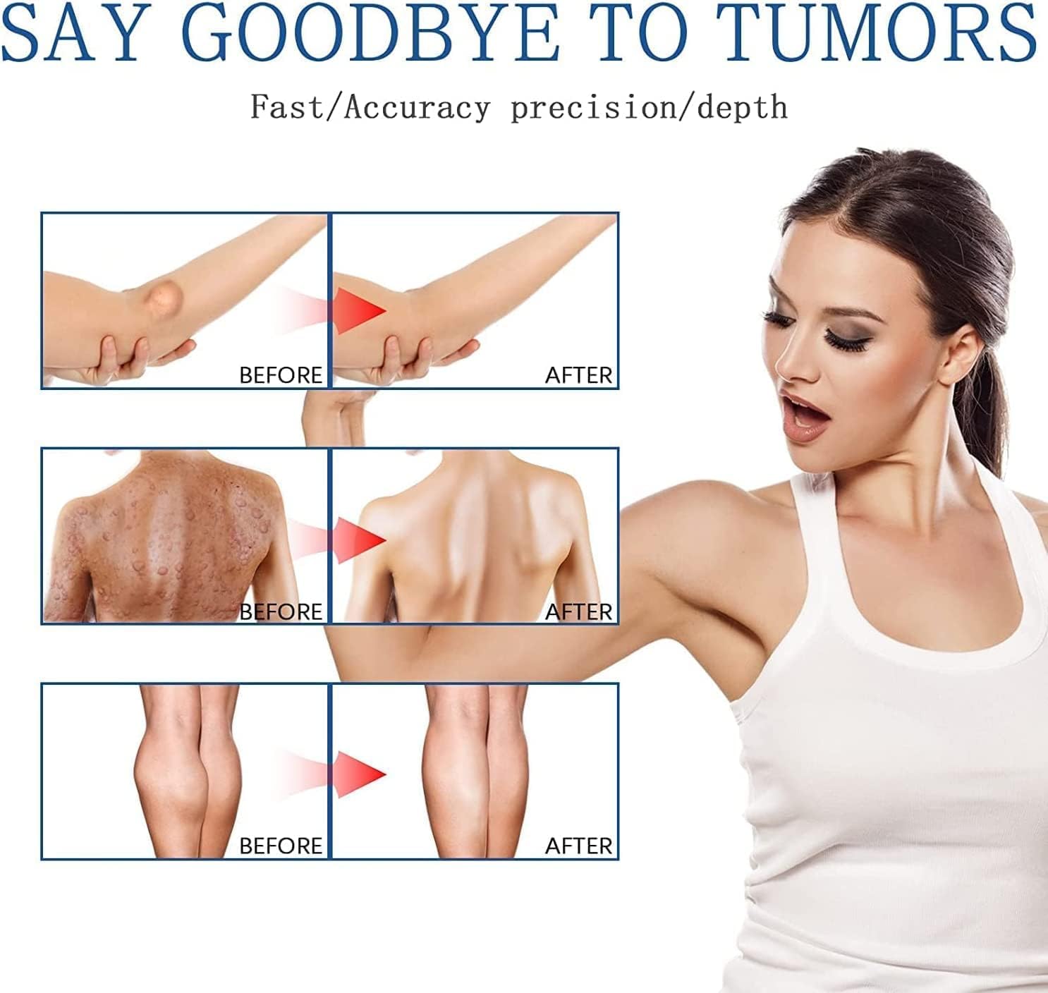 South Moon - Lipoma Removal Spray - Zambeel